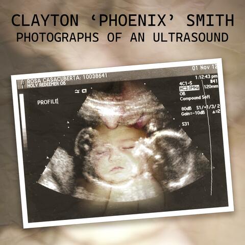 Photographs Of An Ultrasound