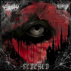 Severed (feat. Rogueways)
