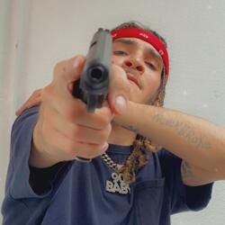 GSW (Gun Shot Wound)