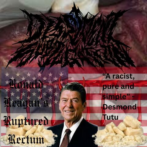 Ronald Reagans Ruptured Rectum