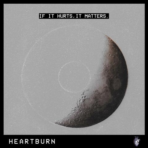 If It Hurts, It Matters