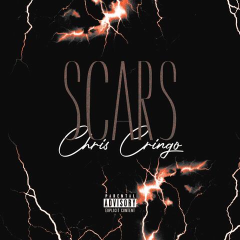 Scars