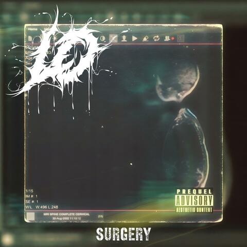 Surgery