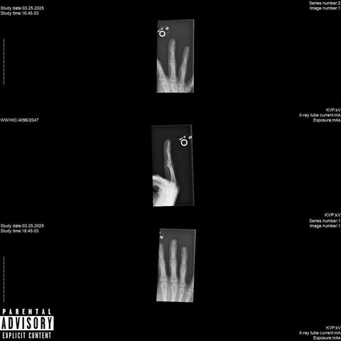 BROKEN FINGER FILES