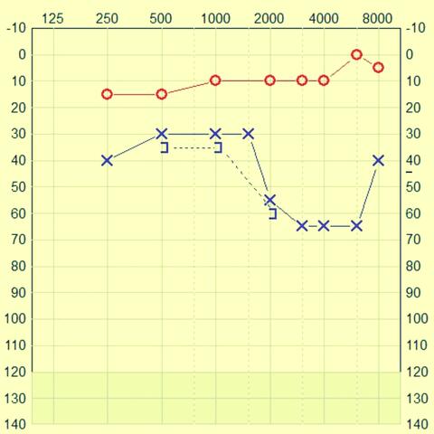 I can't hear you now