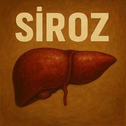 Siroz