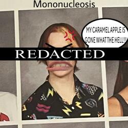 Mononucleosis