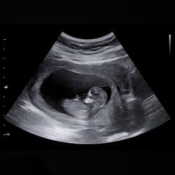 I Got Another On the Way