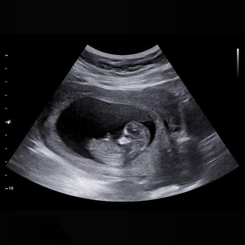 I Got Another On the Way