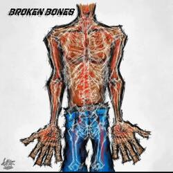 Broken bones