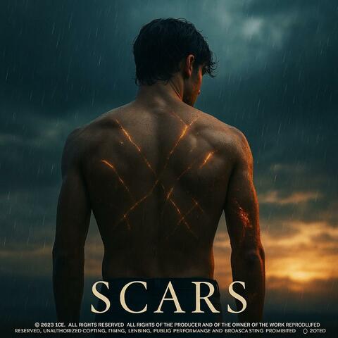 Scars