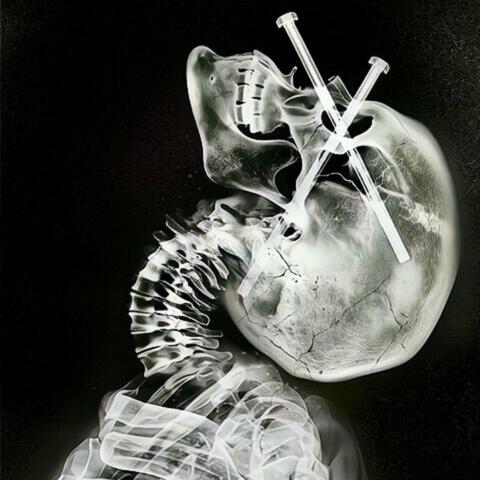 Probleme mit dem Kopf