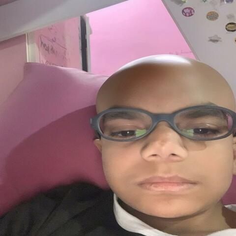 ALOPECIA
