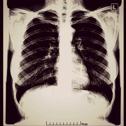 how depression feels like