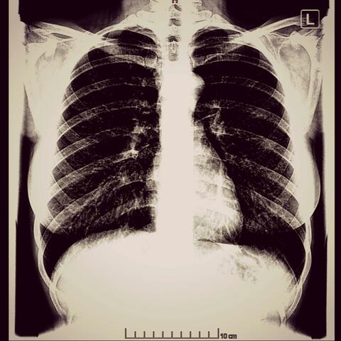 how depression feels like