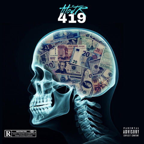 419