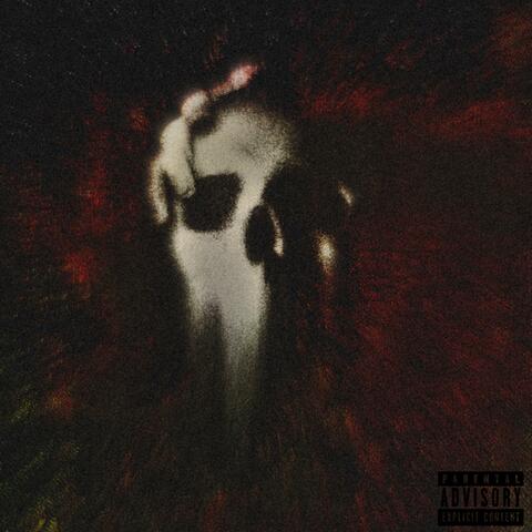 Migraine
