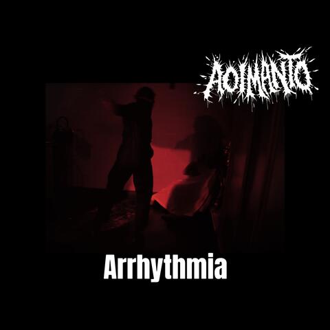 Arrhythmia