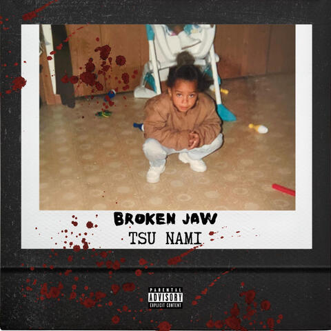 Broken Jaw