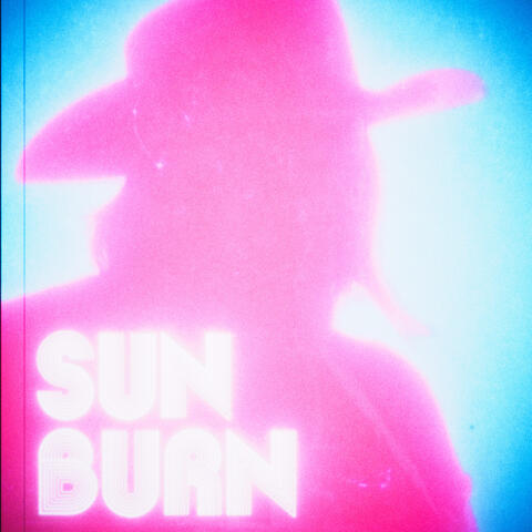 Sunburn