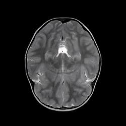 ÜLTRA EXPERIMENTAL MIND