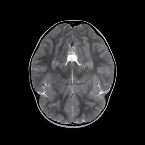 ÜLTRA EXPERIMENTAL MIND