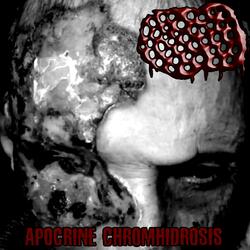 Apocrine Chromhidrosis - My Skin Is Infested With Mites And Covered In Shit