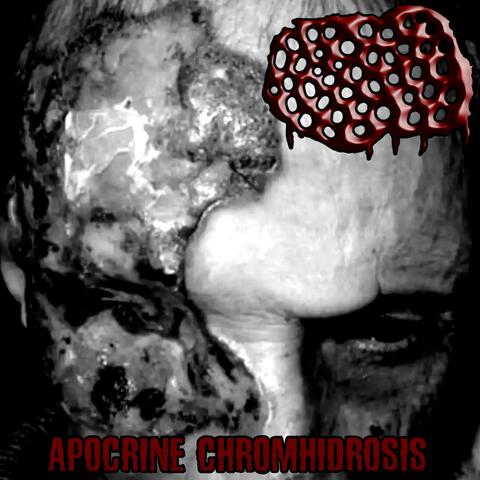 Apocrine Chromhidrosis - My Skin Is Infested With Mites And Covered In Shit