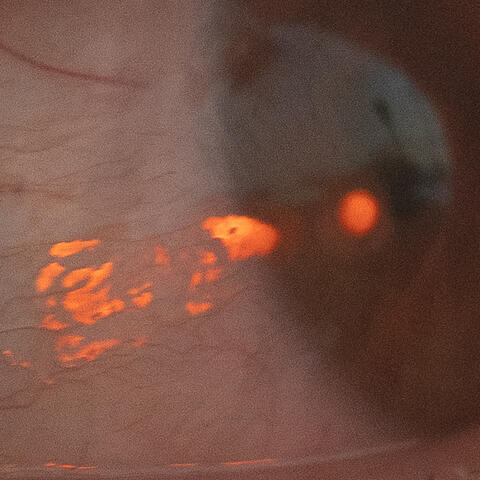 Hurt A Fly