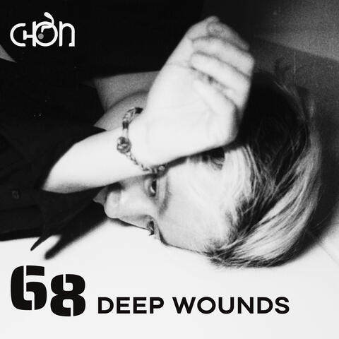 68 Deep Wounds