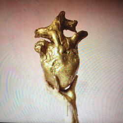 Solid Gold