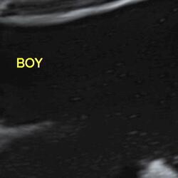 Boy