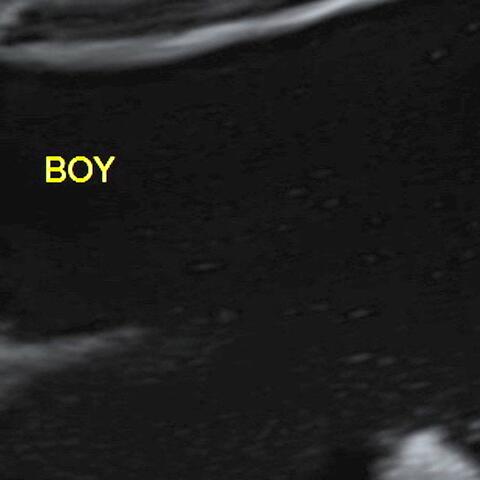 Boy