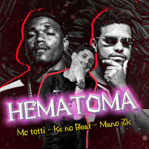 Hematoma