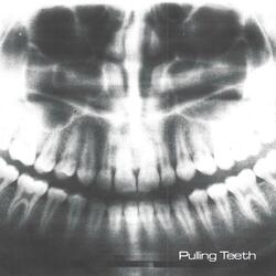 Pulling Teeth