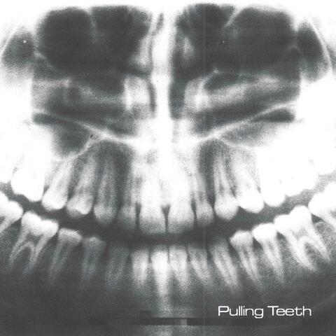 Pulling Teeth