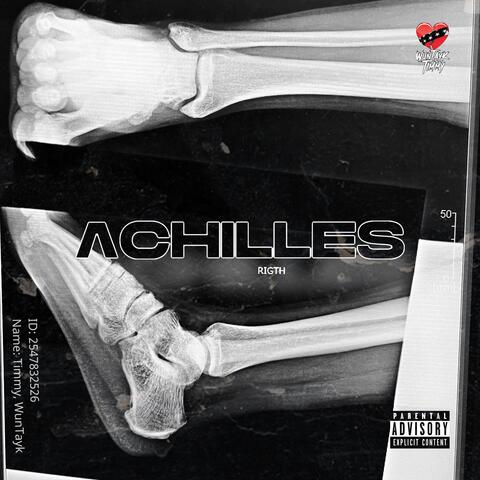 Achilles