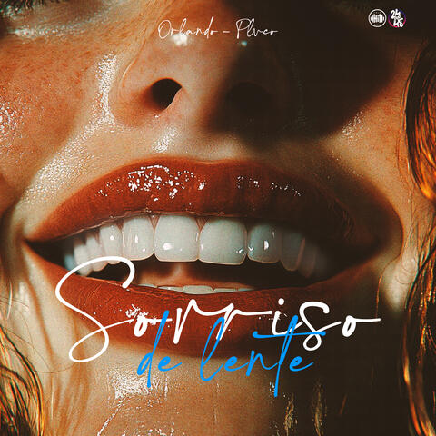 Sorriso de Lente