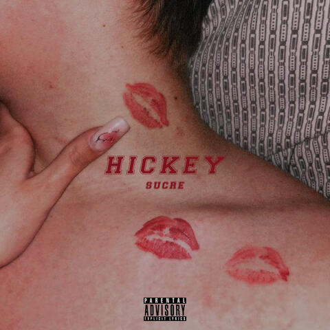 Hickey