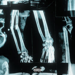 Bones