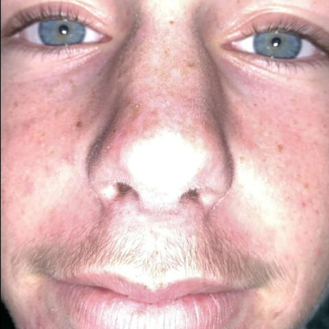 I Lost My Dick