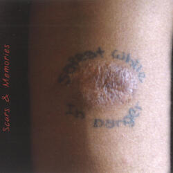 Scars and Memories