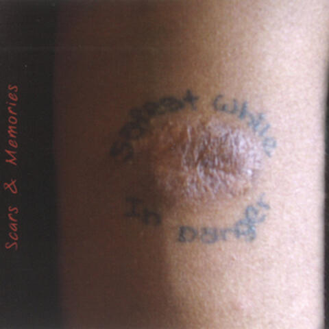 Scars & Memories