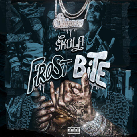 Frostbite