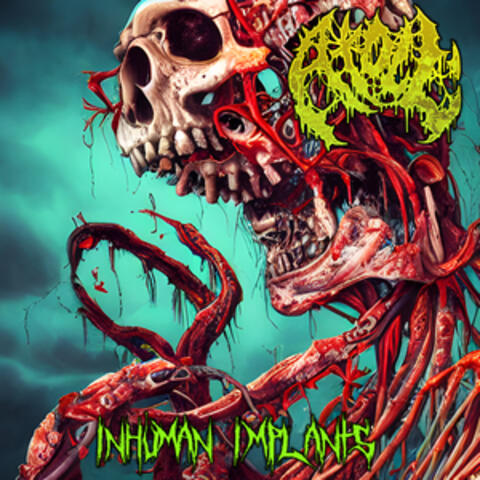Inhuman Implants