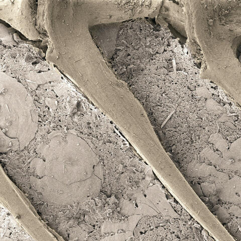 Fish Bone