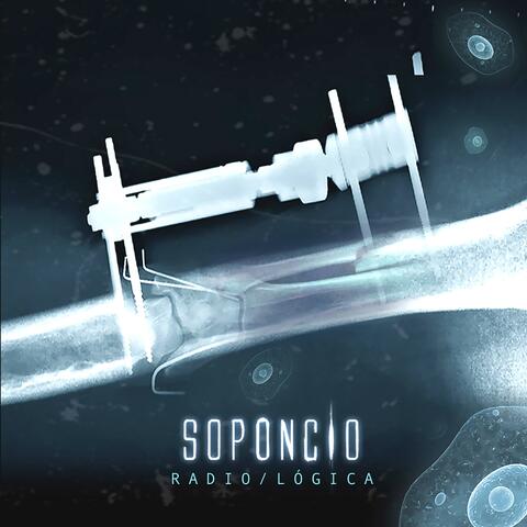 Radio / Lógica