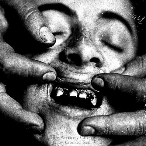 Yellow Crooked Teeth