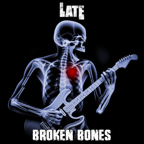 Broken Bones