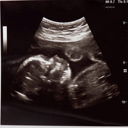 Womb Sound 5 - Endless Loop